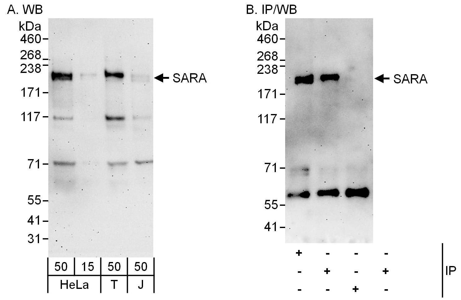 ZFYVE9 Antibody