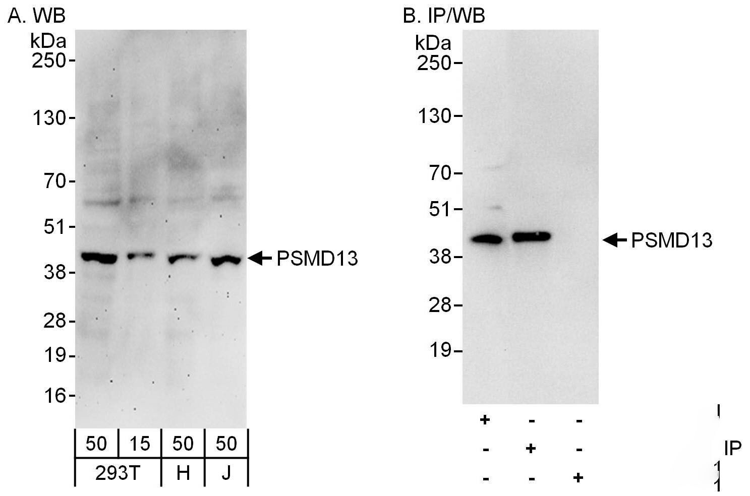 PSMD13 Antibody