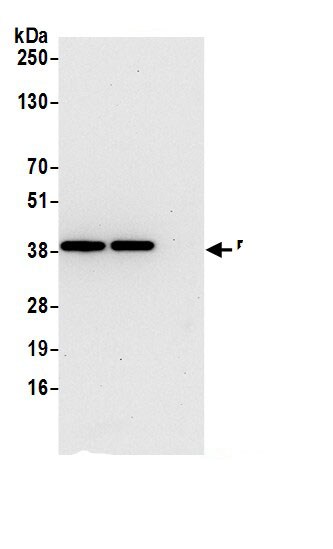 RPRD1B Antibody