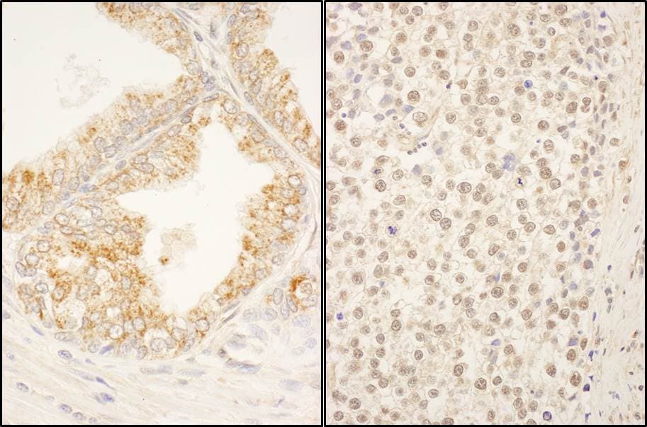 F box protein 38 Antibody