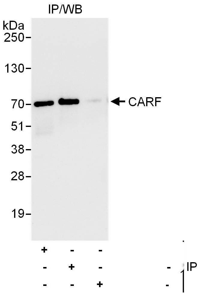 CARF/CDKN2AIP Antibody