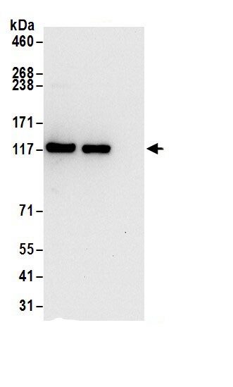 CHERP Antibody