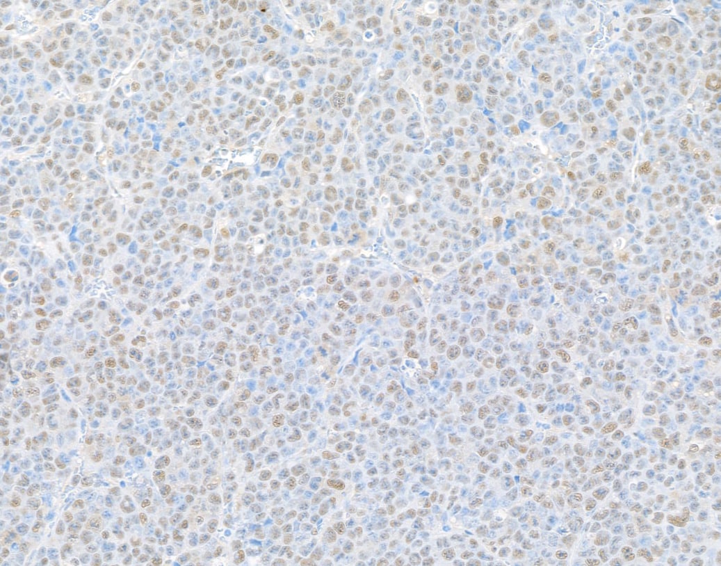 Rpn2 Antibody