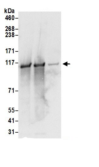 VDP p115 Antibody