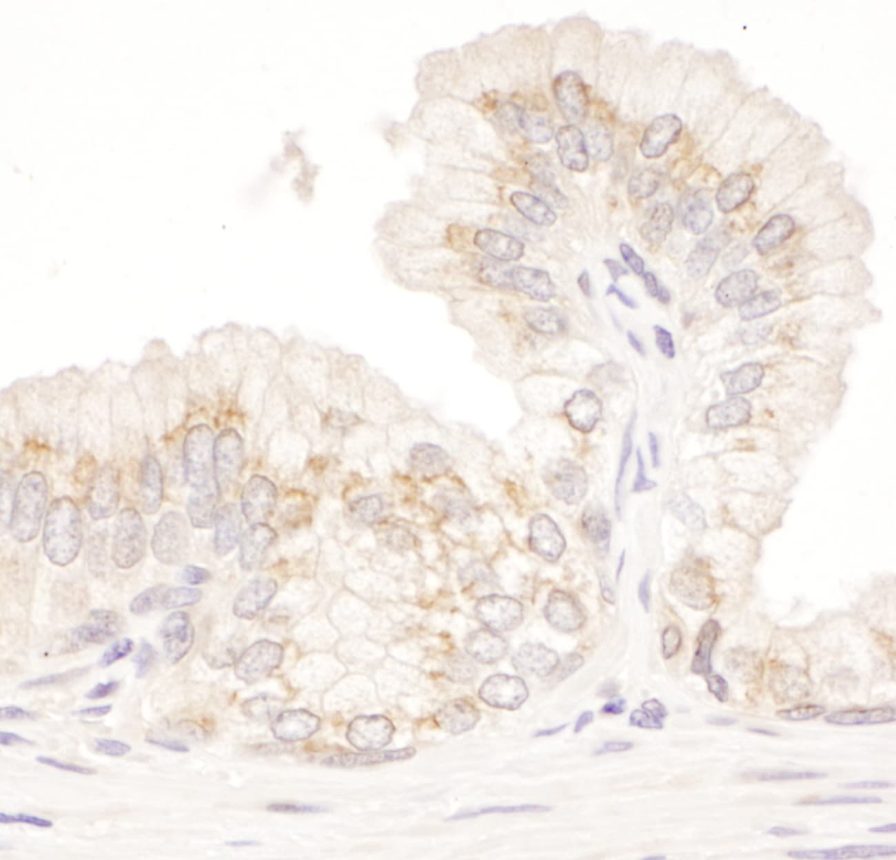 GM130/GOLGA2 Antibody
