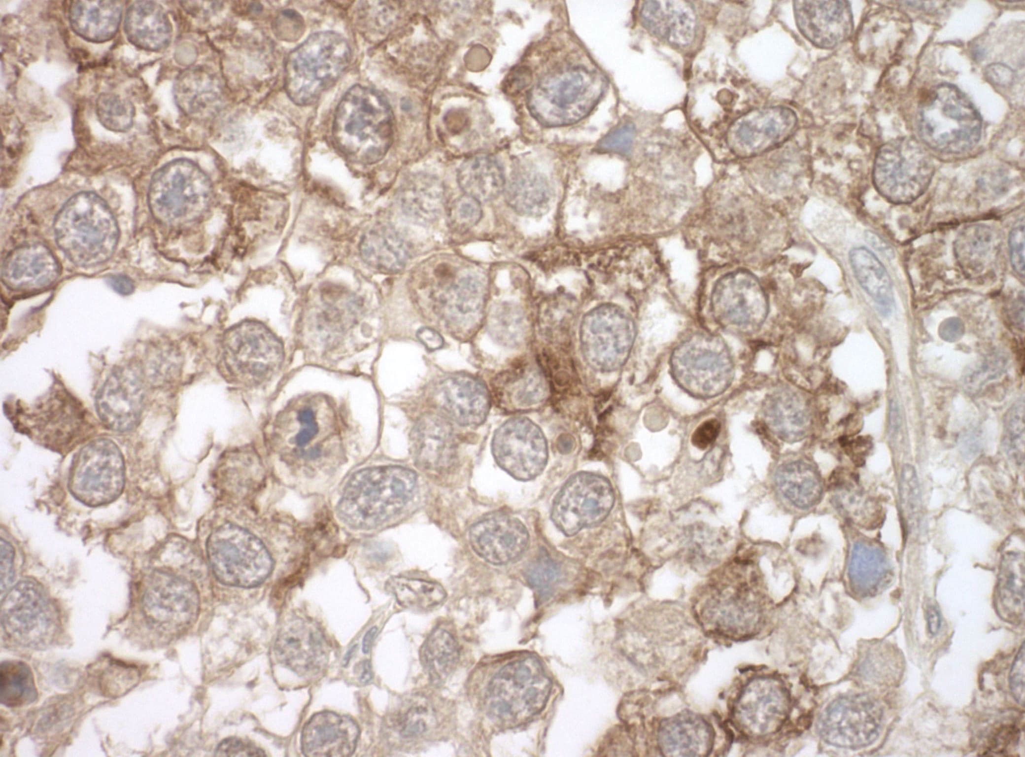 MOV10 Antibody (15C1B8)