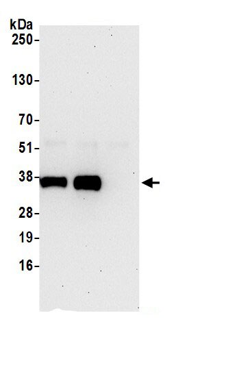 PPA2 Antibody
