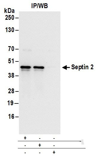 Septin-2 Antibody
