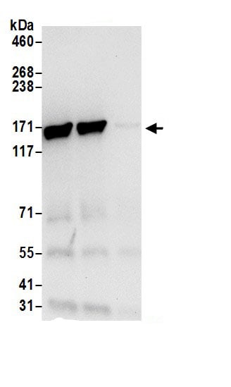Isoleucyl tRNA synthetase Antibody