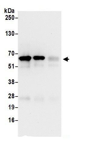 IF3EI Antibody