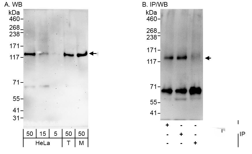 ARHGAP11A Antibody