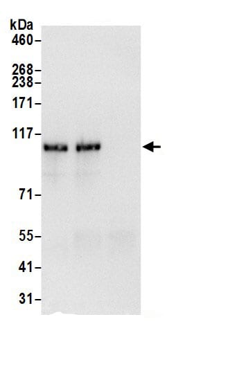 HIP1 Antibody