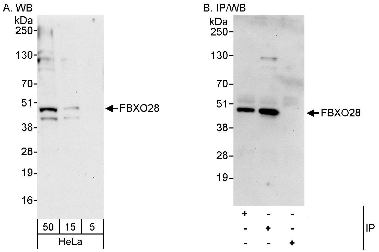 FBXO28 Antibody