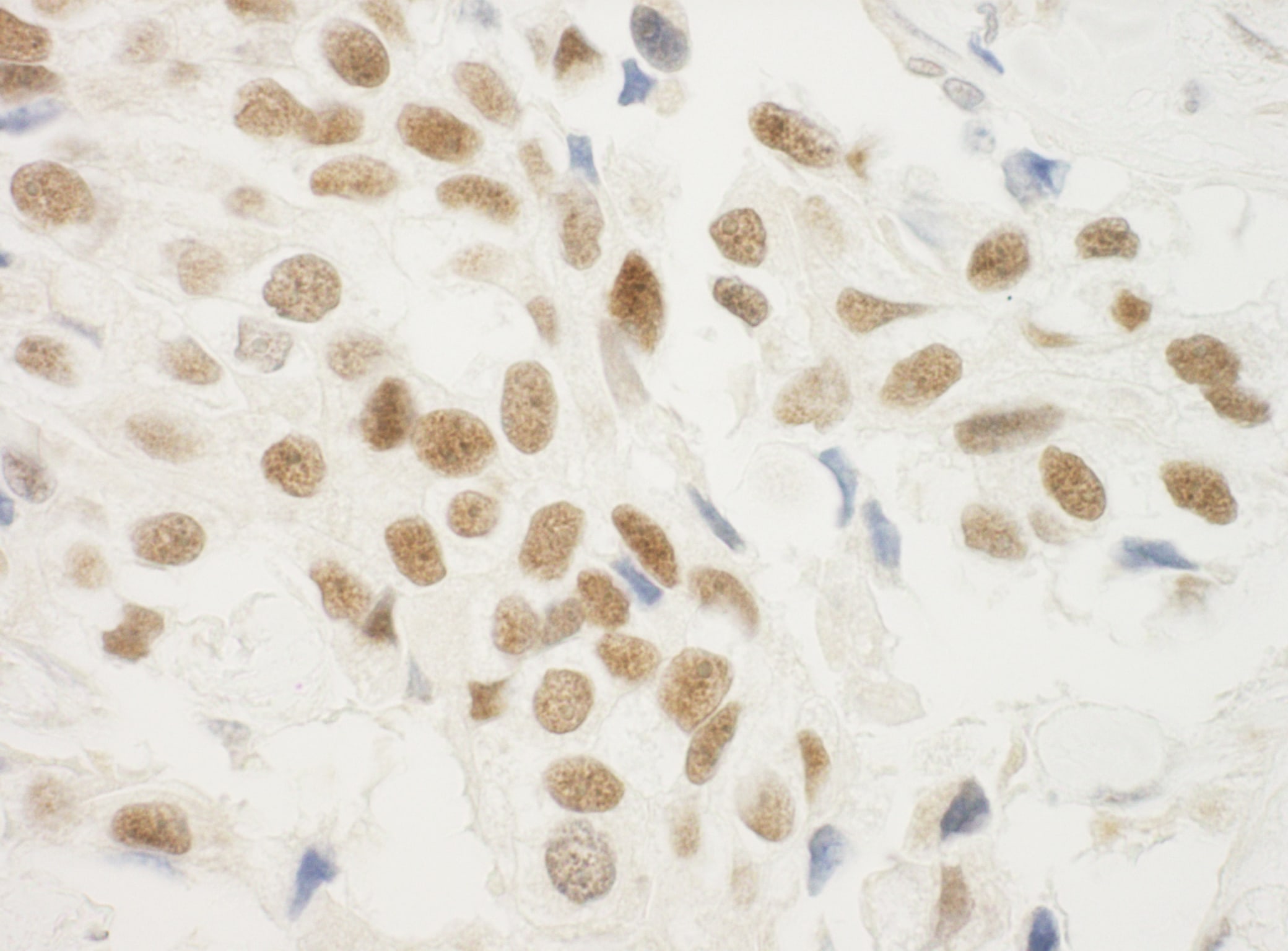 ZNF768 Antibody