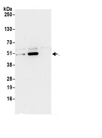 RPL3 Antibody