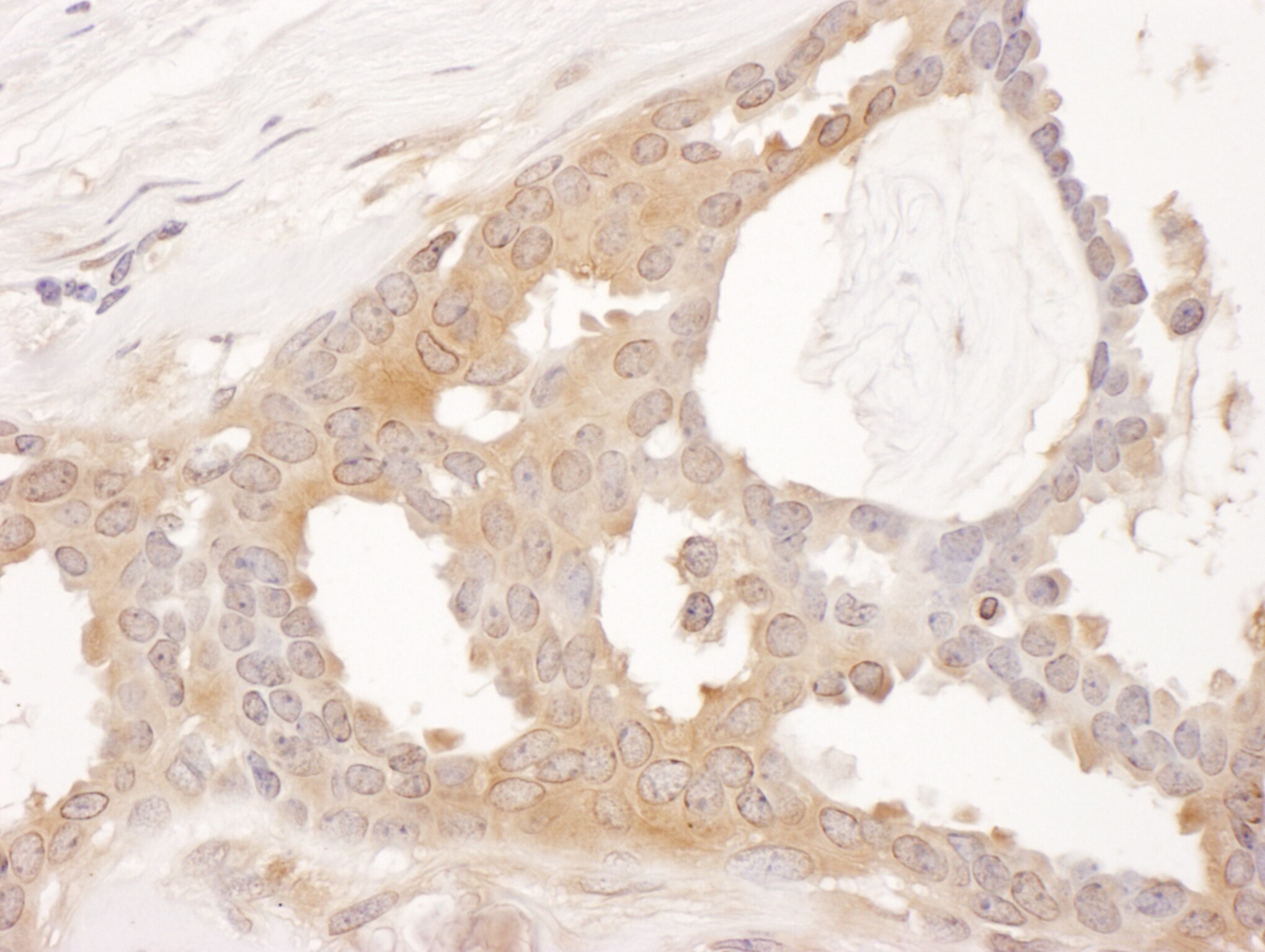 CCT8 Antibody