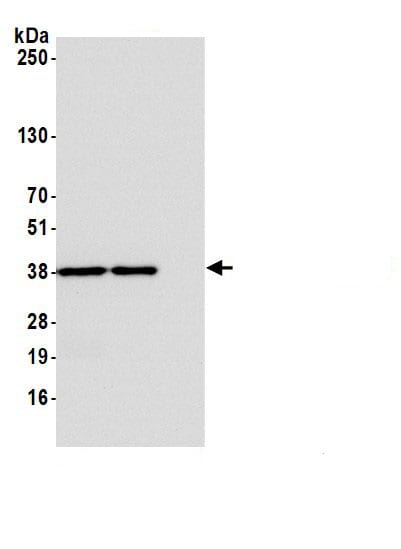 STING/TMEM173 Antibody