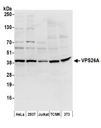 VPS26A Antibody