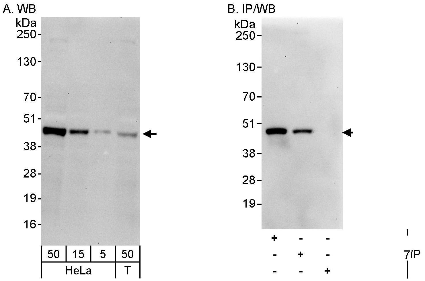 CAMKID Antibody