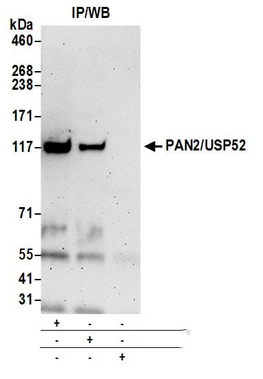 USP52 Antibody