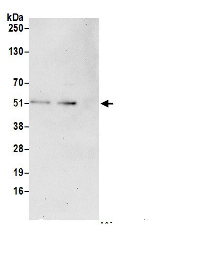 CEP44 Antibody