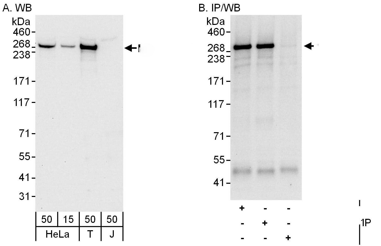 Desmoplakin Antibody