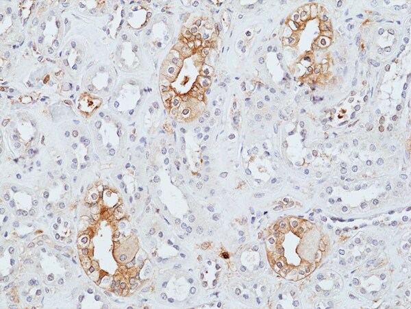 Uroplakin II Antibody (RM507)