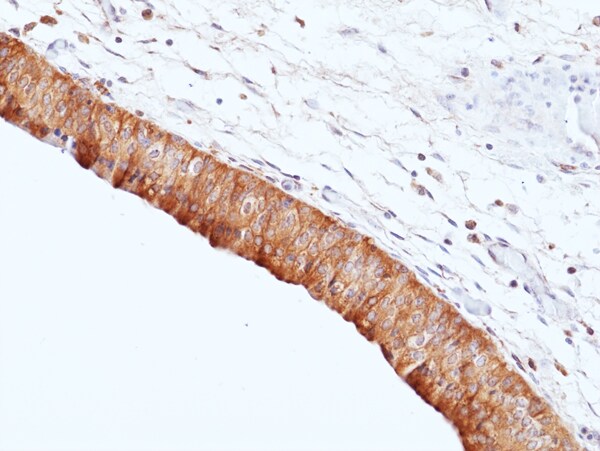 Uroplakin II Antibody (RM507)