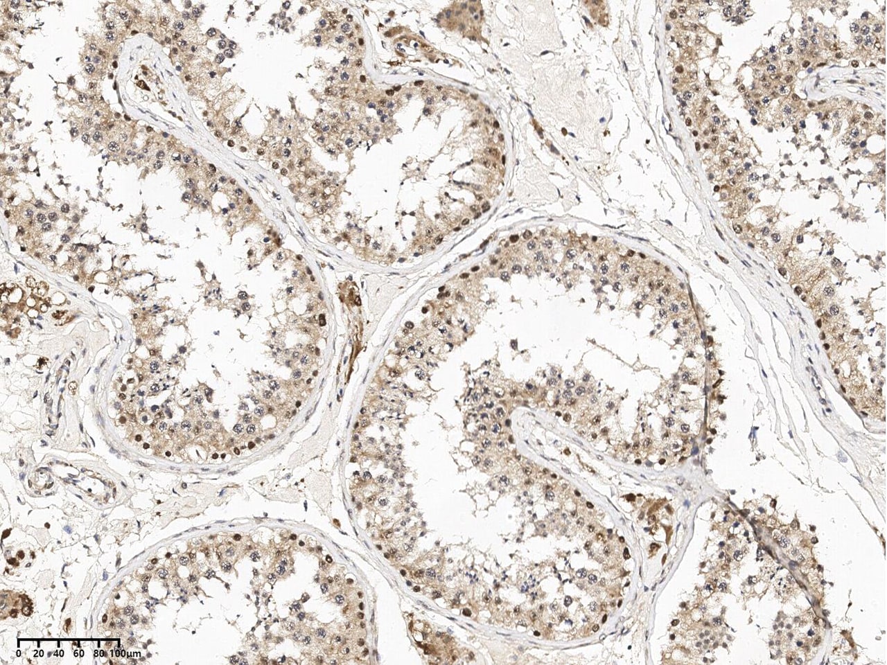 FDX1L Antibody