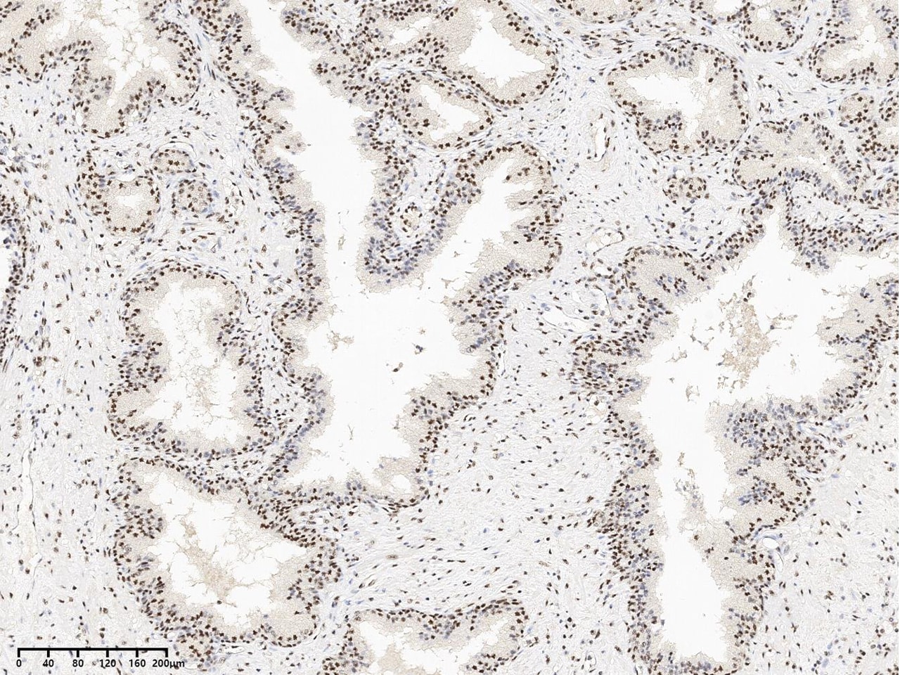 SON Antibody - BSA Free