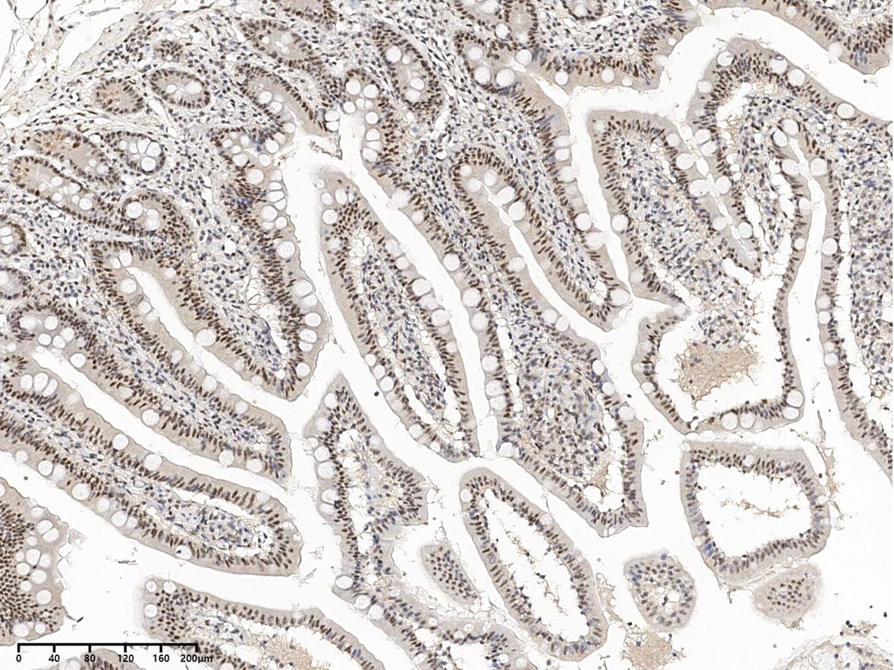 SON Antibody - BSA Free