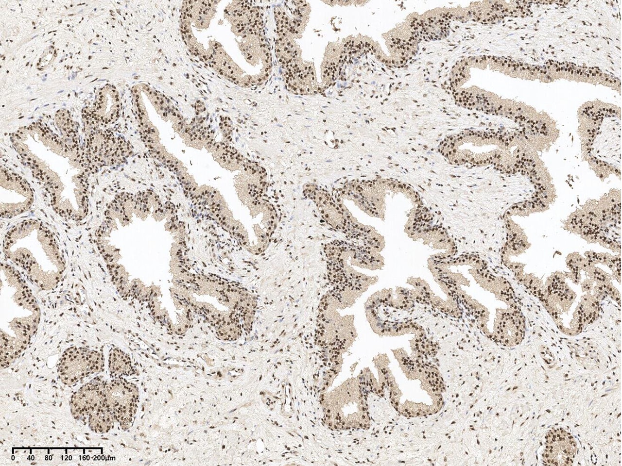 SON Antibody - BSA Free