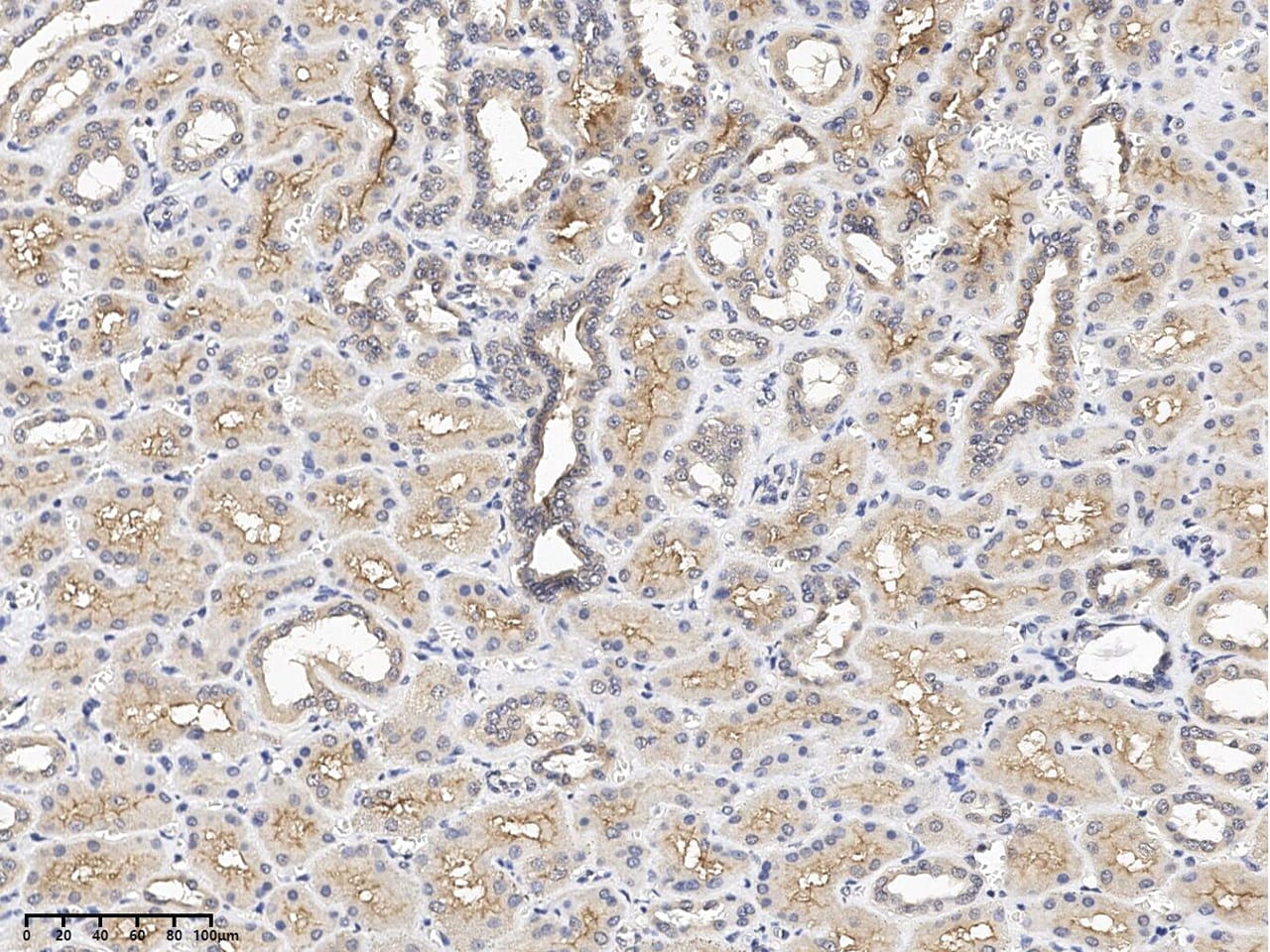 dystrophia myotonica containing WD repeat motif Antibody - BSA Free