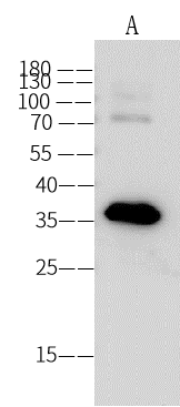 Dengue Virus NS5 Antibody (02) - (New Guinea C) - Azide and BSA Free