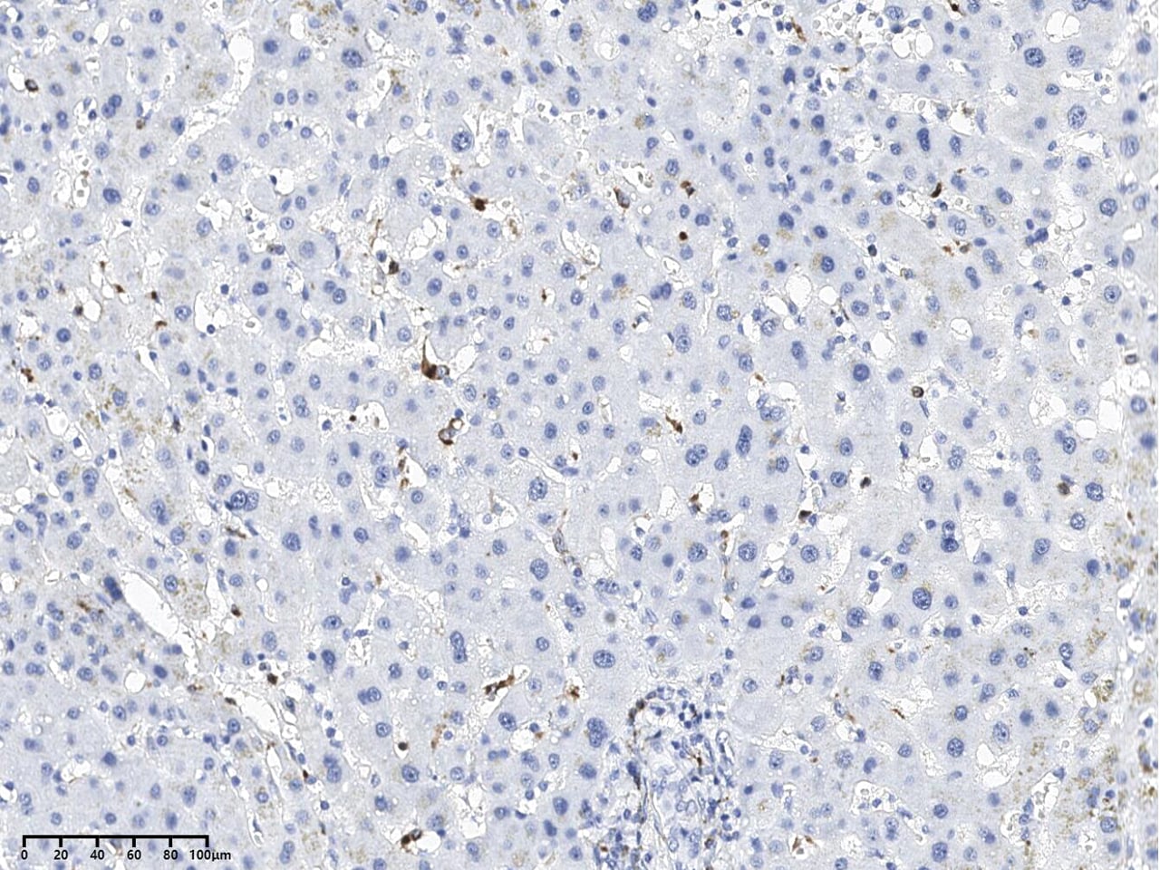 Lysozyme Antibody (095) - Azide and BSA Free