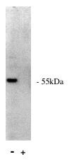 PPP2R5A Antibody