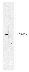PPP2R5A Antibody