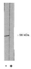 PP2A alpha/beta Antibody