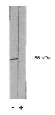 PP2A alpha/beta Antibody
