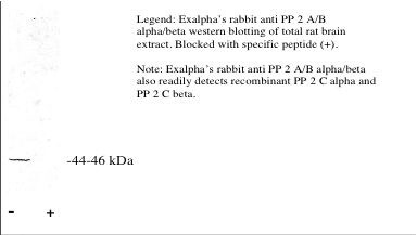 PP2C beta/PPM1B Antibody