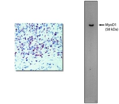 MyoD Antibody (5.2F)