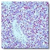 Myogenin Antibody (F12B)