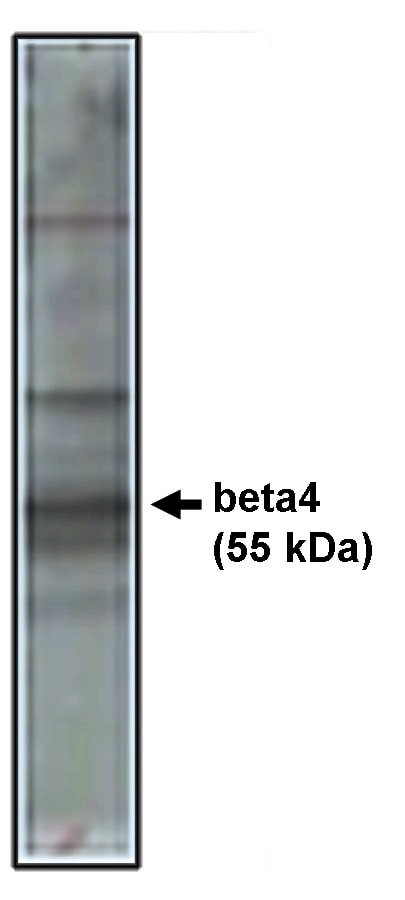 CACNB4 Antibody