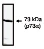 p73 Antibody - C-terminus