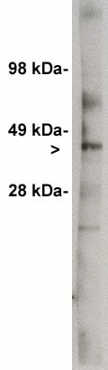 UGCG Antibody