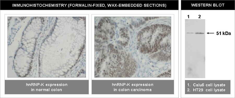 hnRNP K Antibody (F45 P9 C7)