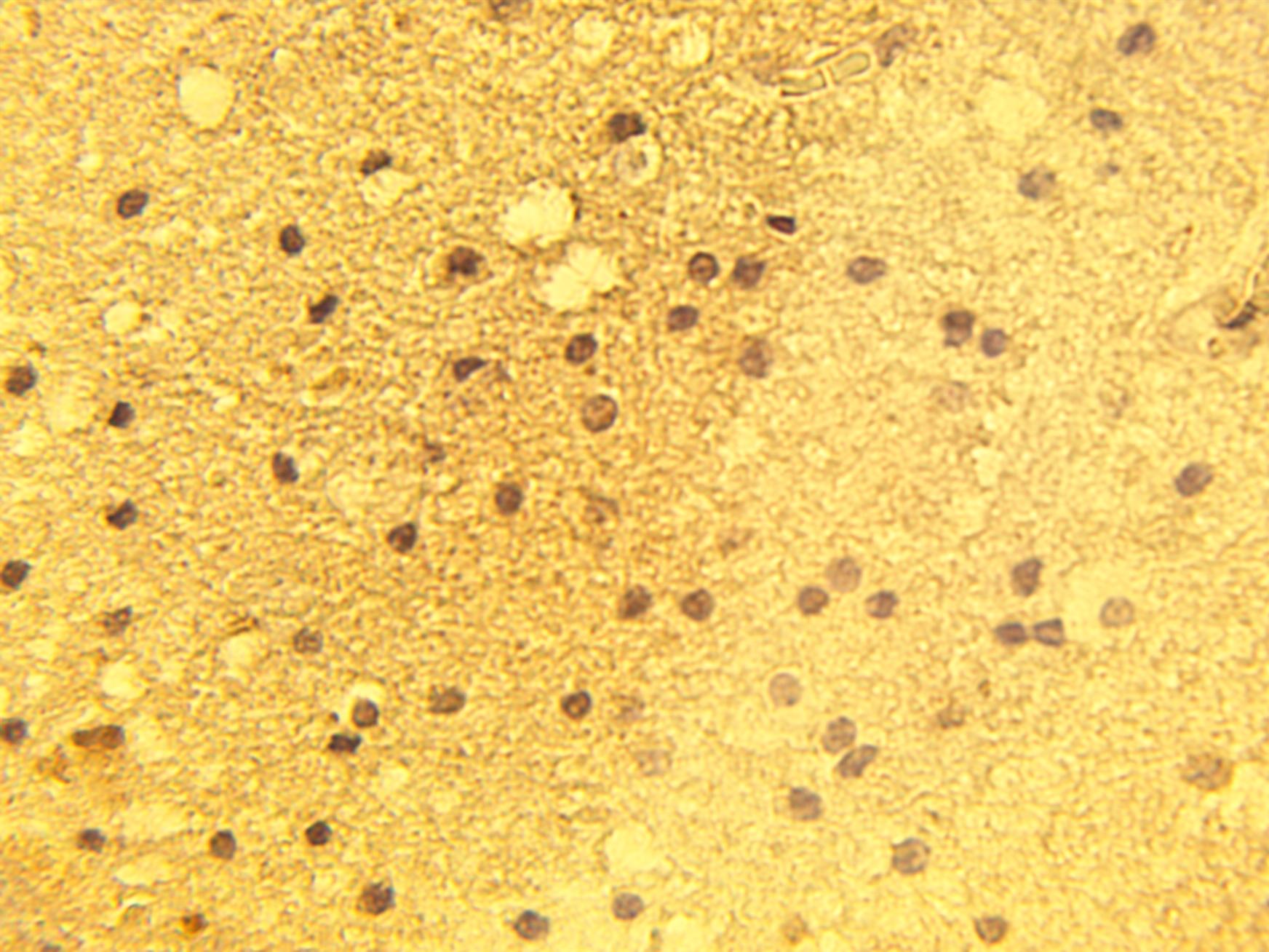 CACNA1A Antibody