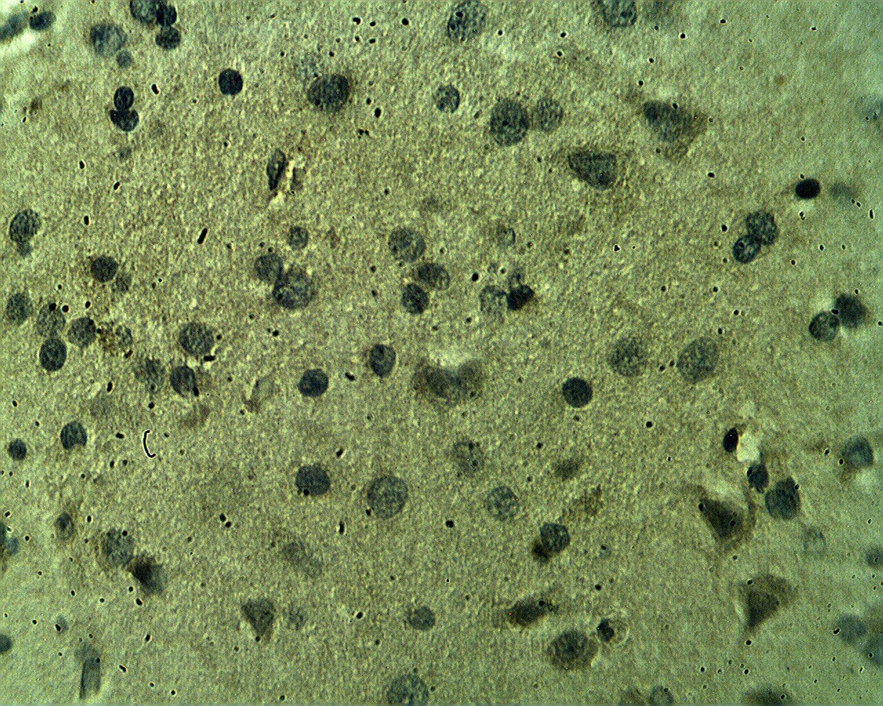 CSP Antibody
