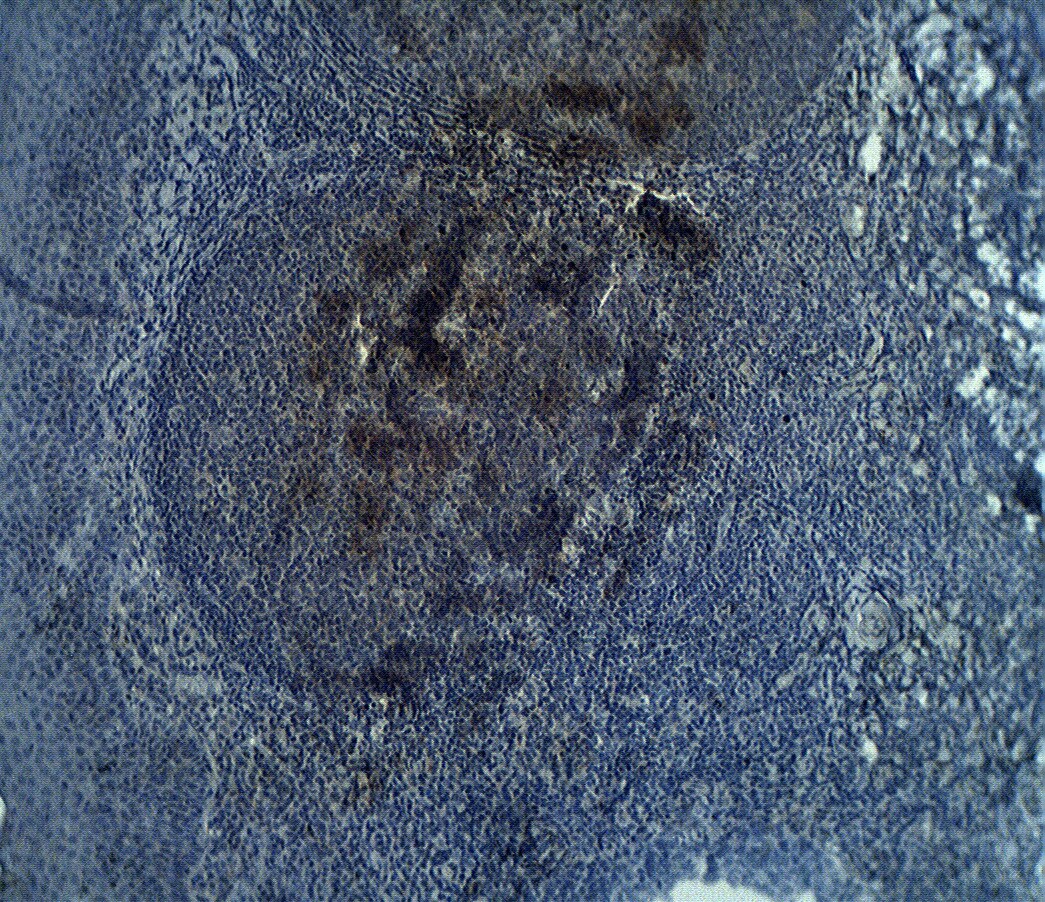 ADAMDEC1 Antibody