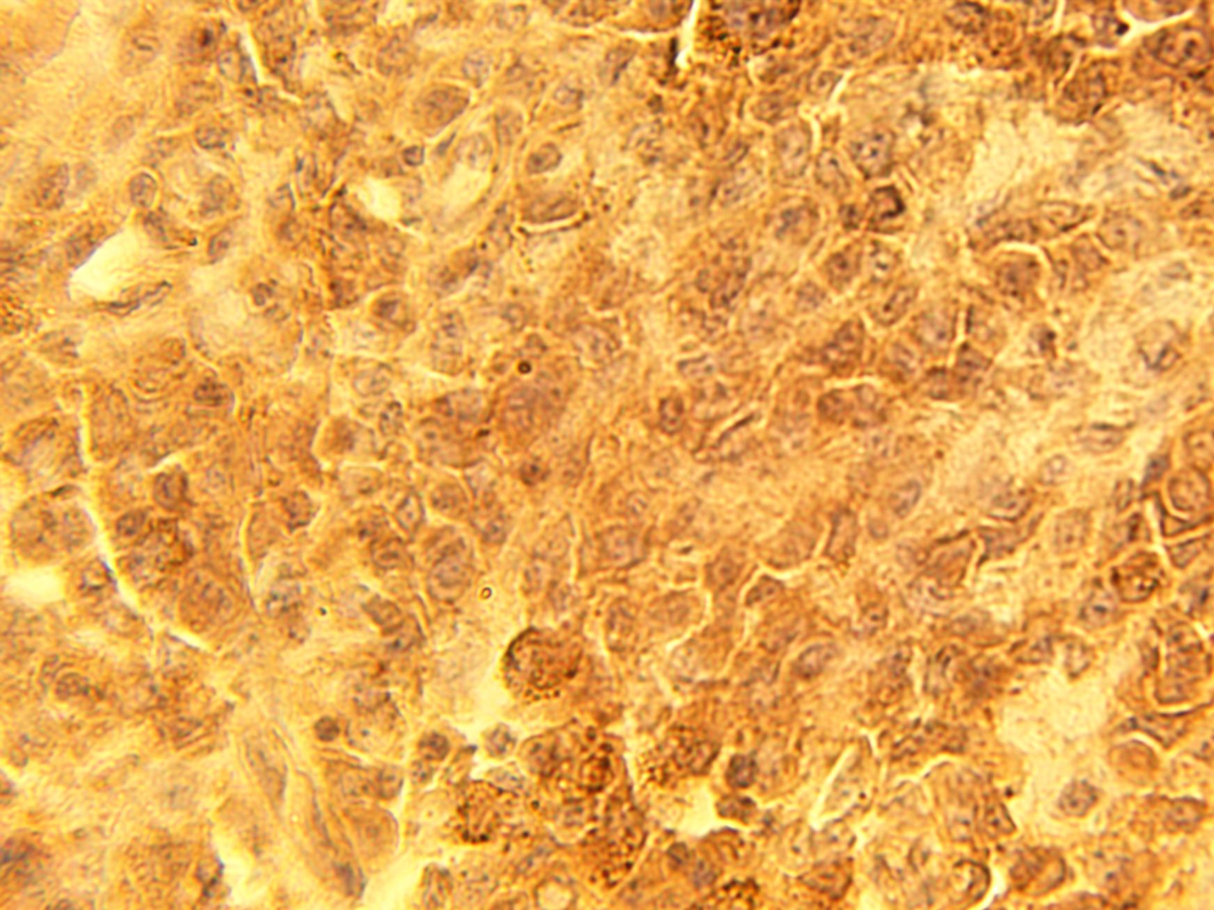 CSP Antibody